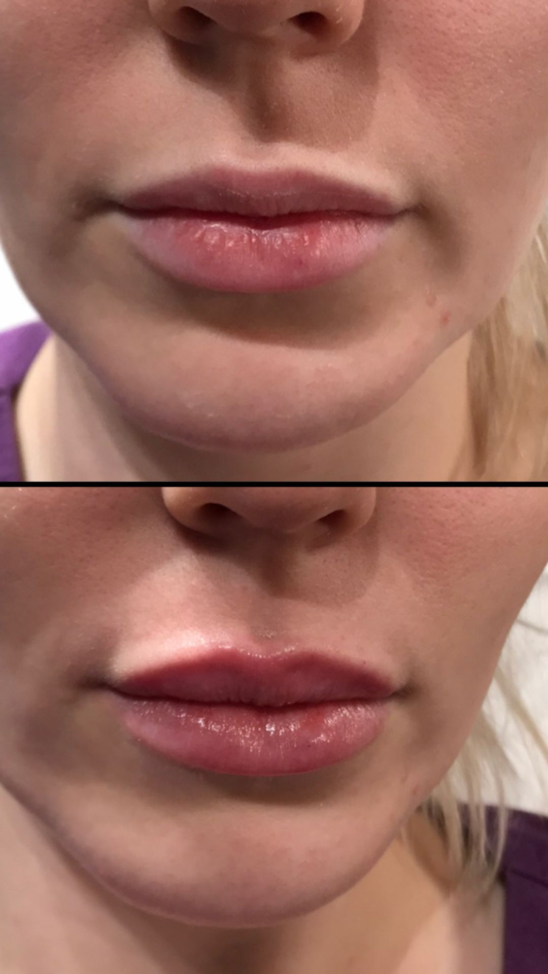 Fresh Faces Aesthetics Clinic Fresh Faces Aesthetics Clinic