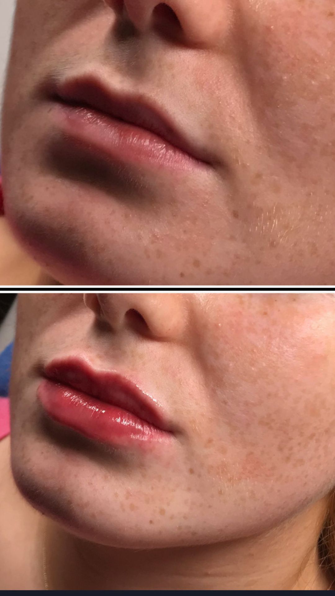 Fresh Faces Aesthetics Clinic Fresh Faces Aesthetics Clinic