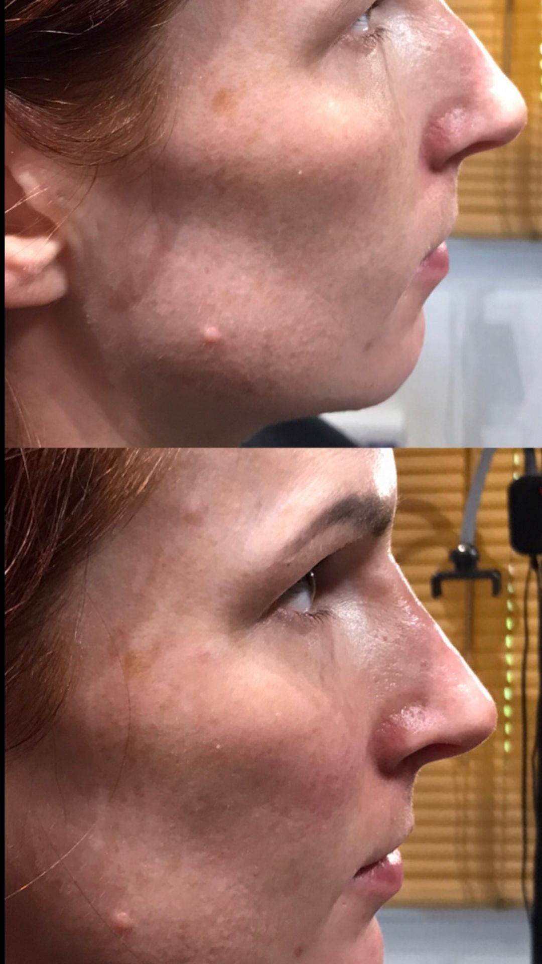 Fresh Faces Aesthetics Clinic Fresh Faces Aesthetics Clinic