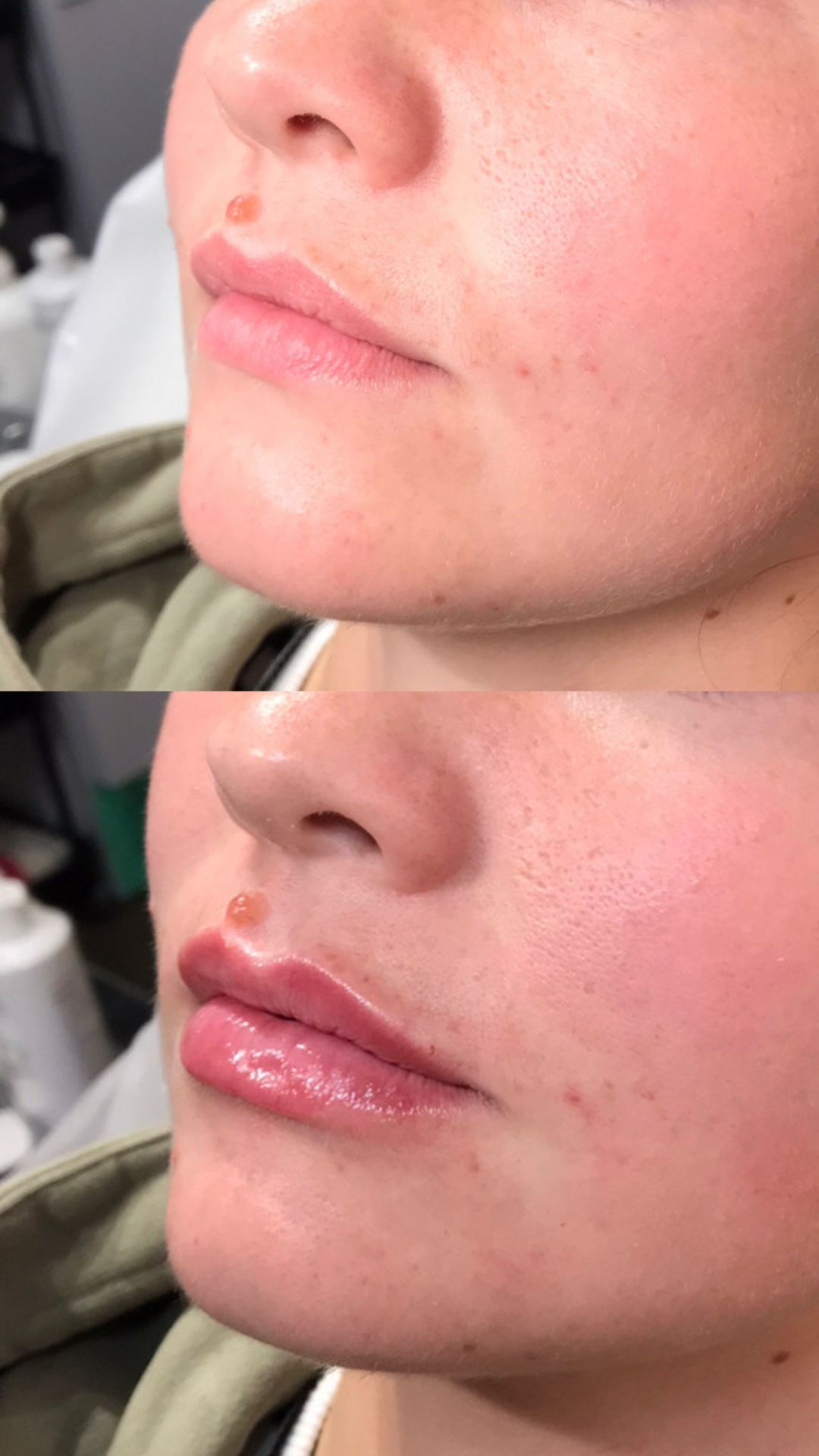Fresh Faces Aesthetics Clinic Fresh Faces Aesthetics Clinic