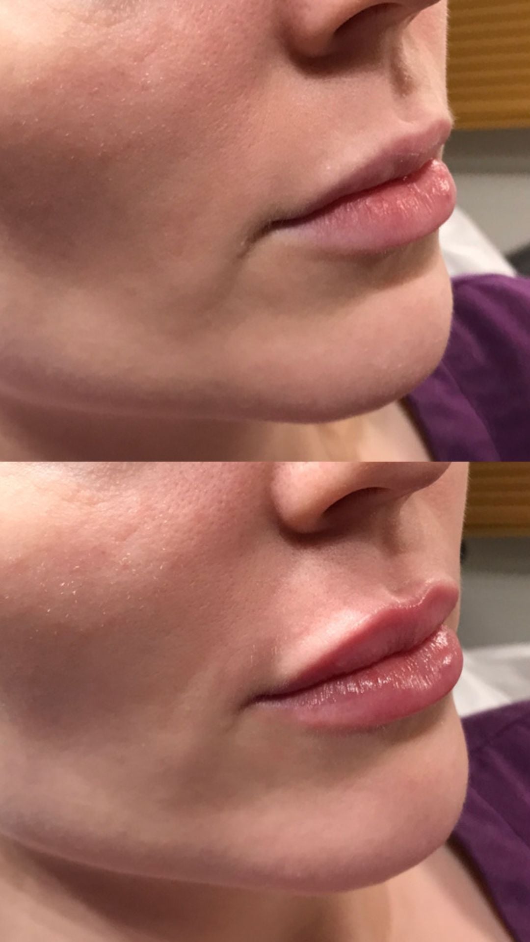 Fresh Faces Aesthetics Clinic Fresh Faces Aesthetics Clinic