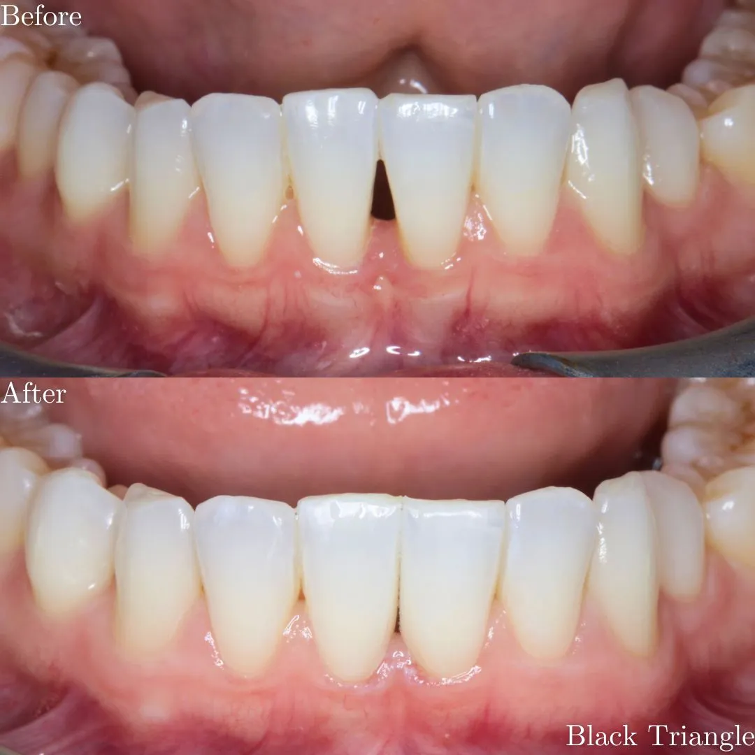 The Grange Dental and Implant Clinic