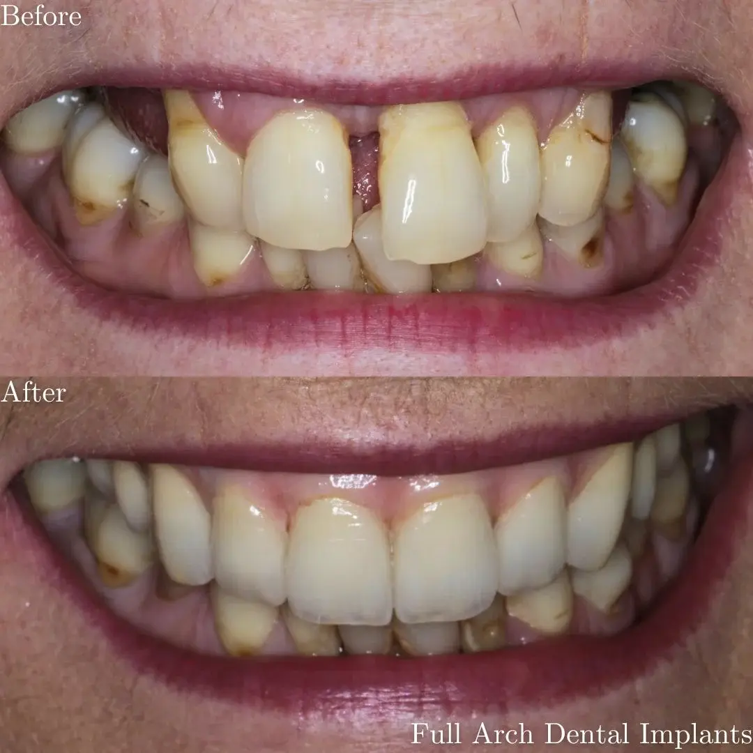 The Grange Dental and Implant Clinic