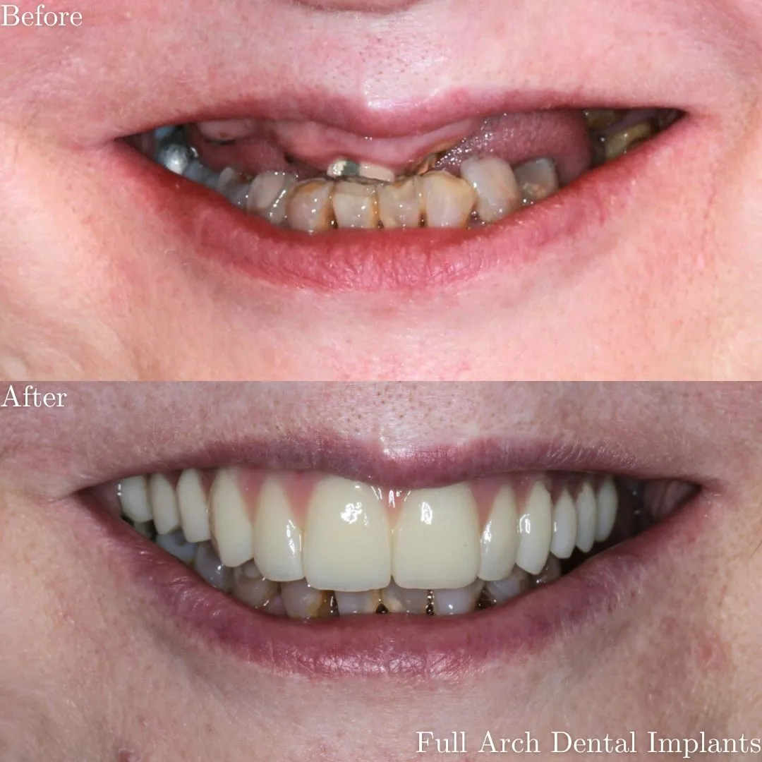 The Grange Dental and Implant Clinic