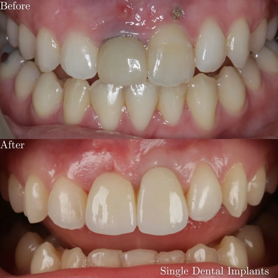 The Grange Dental and Implant Clinic