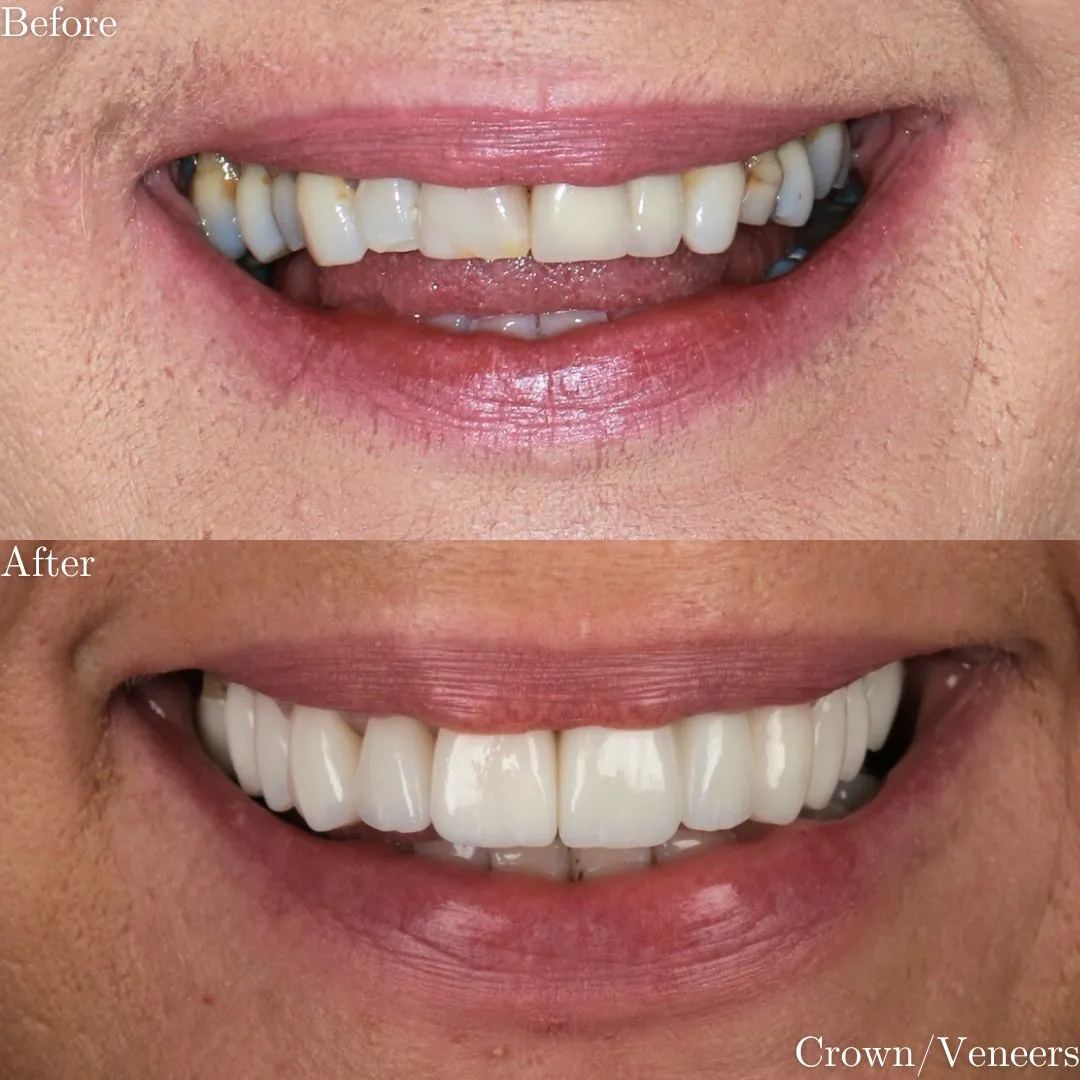 The Grange Dental and Implant Clinic
