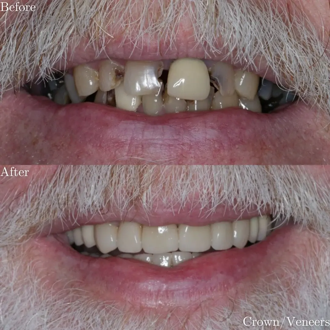 The Grange Dental and Implant Clinic