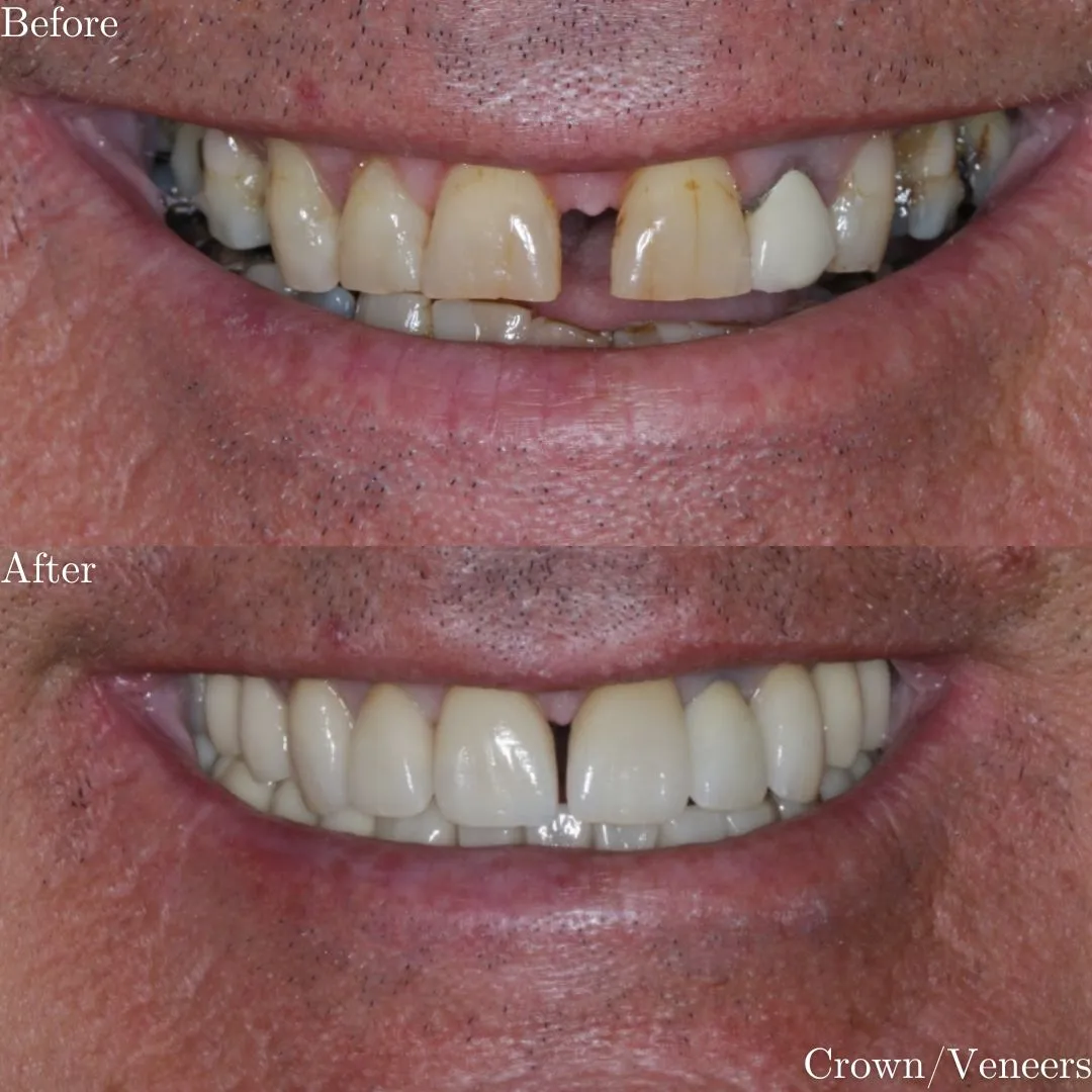 The Grange Dental and Implant Clinic
