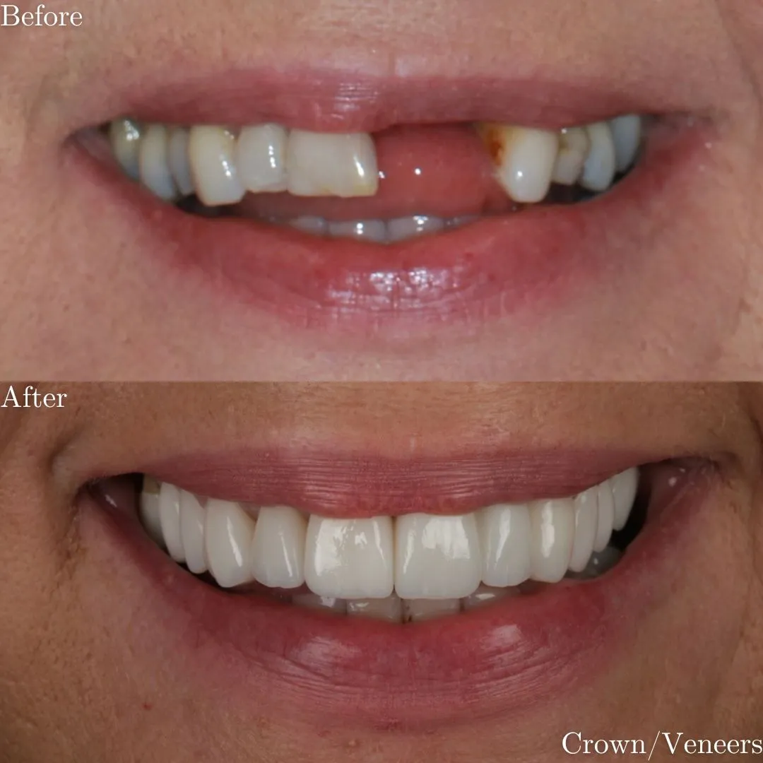 The Grange Dental and Implant Clinic