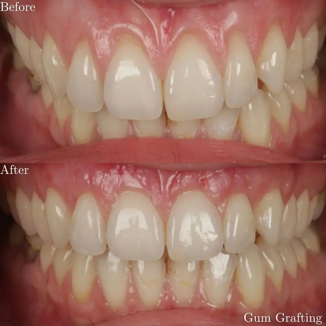 The Grange Dental and Implant Clinic